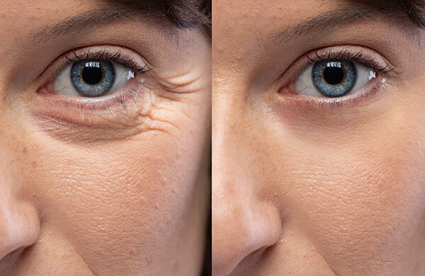 Relato visual Nova Beauty Sérum 5